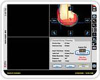 computer-assisted-joint-replacement-clip4